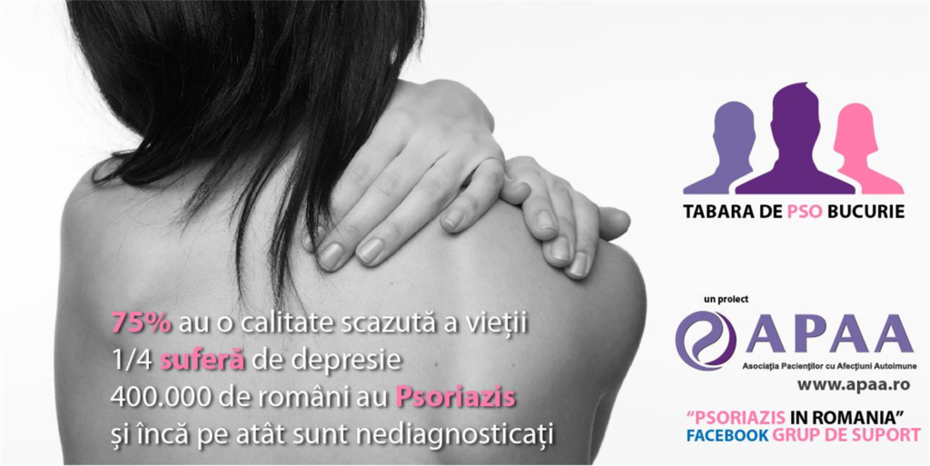 TABĂRA DE PSO BUCURIE